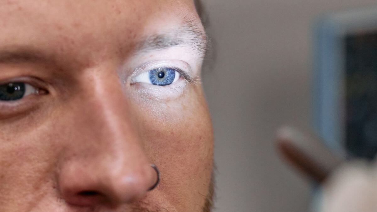 Glaucoma: la enfermedad silenciosa que puedes prevenir a tiempo